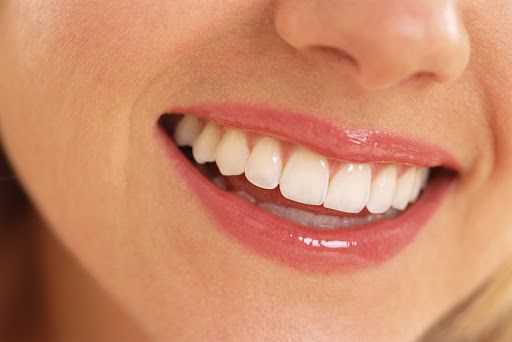 blanqueamiento dental